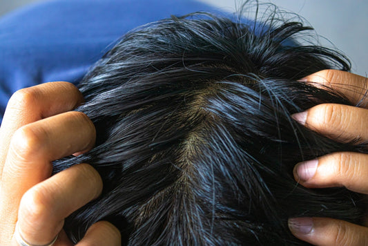 Scalp Health and Sebum Production: Can Having Oily Skin Change the Way Hair Shape Grows?