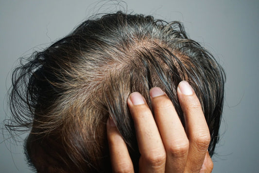 Scalp Health 101: How to Prevent Flaking, Dryness, and Product Buildup 