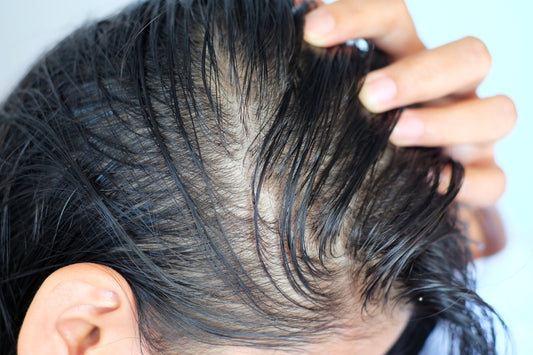 Can Hair Be Naturally Oily? Understanding Your Scalp